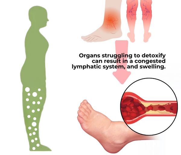 Detox-Fußpflaster gegen Schwellungen (10er-Packung)