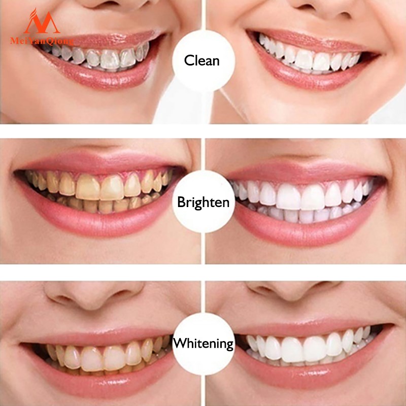 Lápiz blanqueador de dientes
