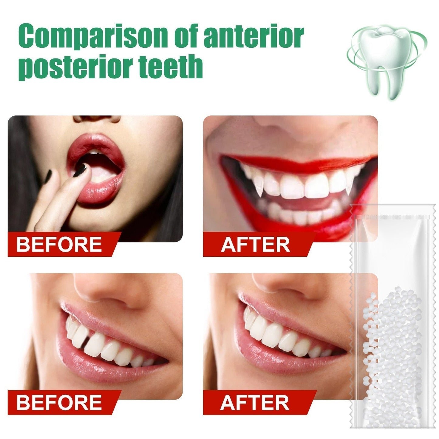 Resina para reparación de dientes