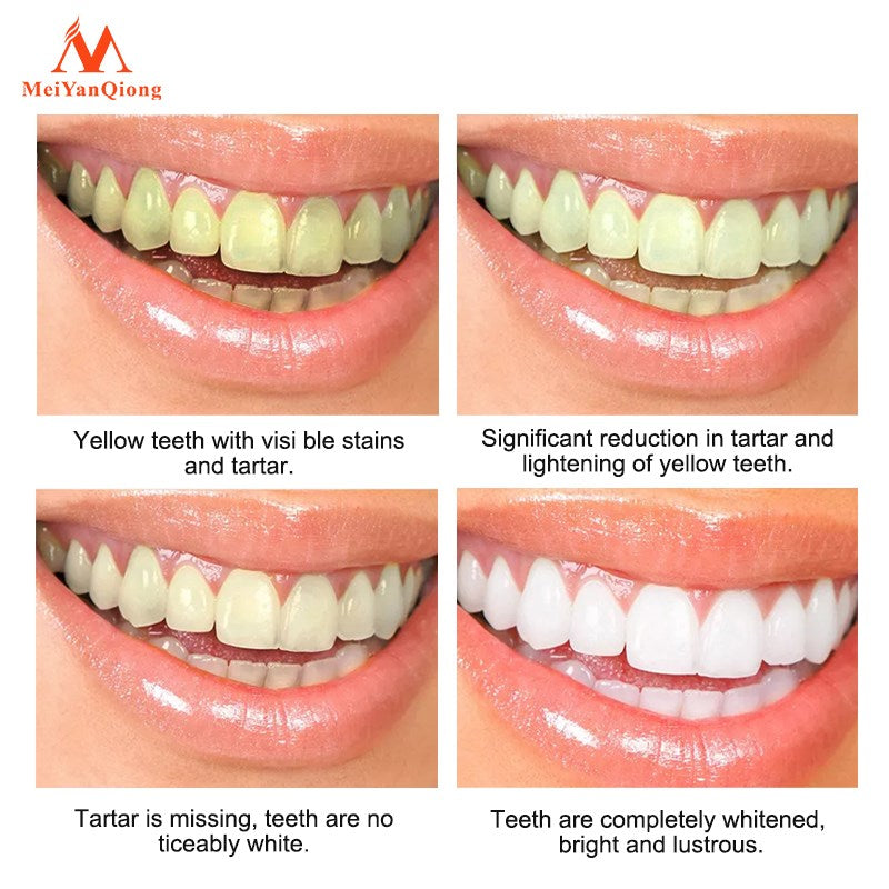 Zahnaufhellungsstift