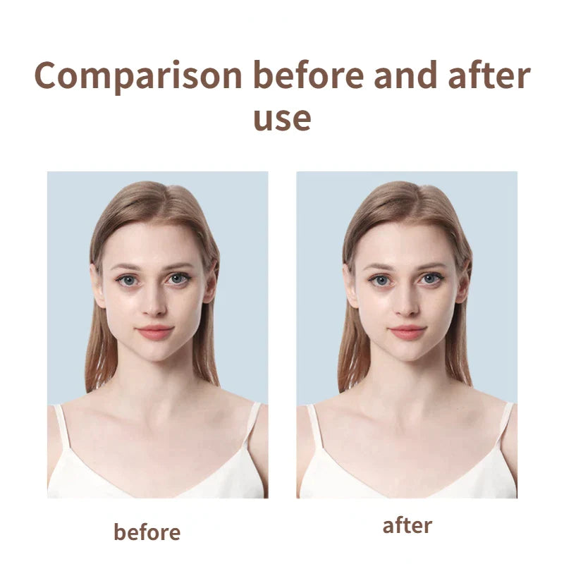 LiftEase: revitalización instantánea del rostro