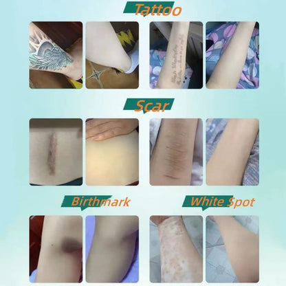 6-teiliges Tattoo- und Narben-Abdeckpflaster