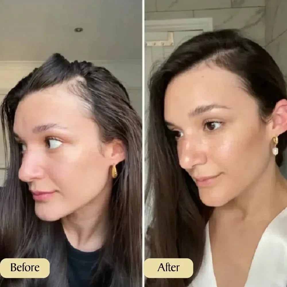 pure carvenchy™ - veganes Haarwuchsöl