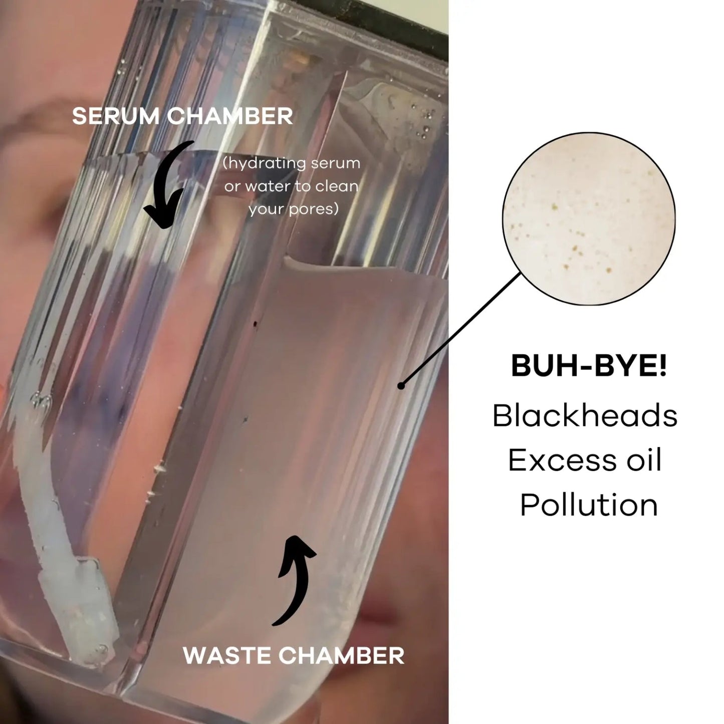 Pore Cleanse: Hydration Handset & Hydra Soothe Serum Kit