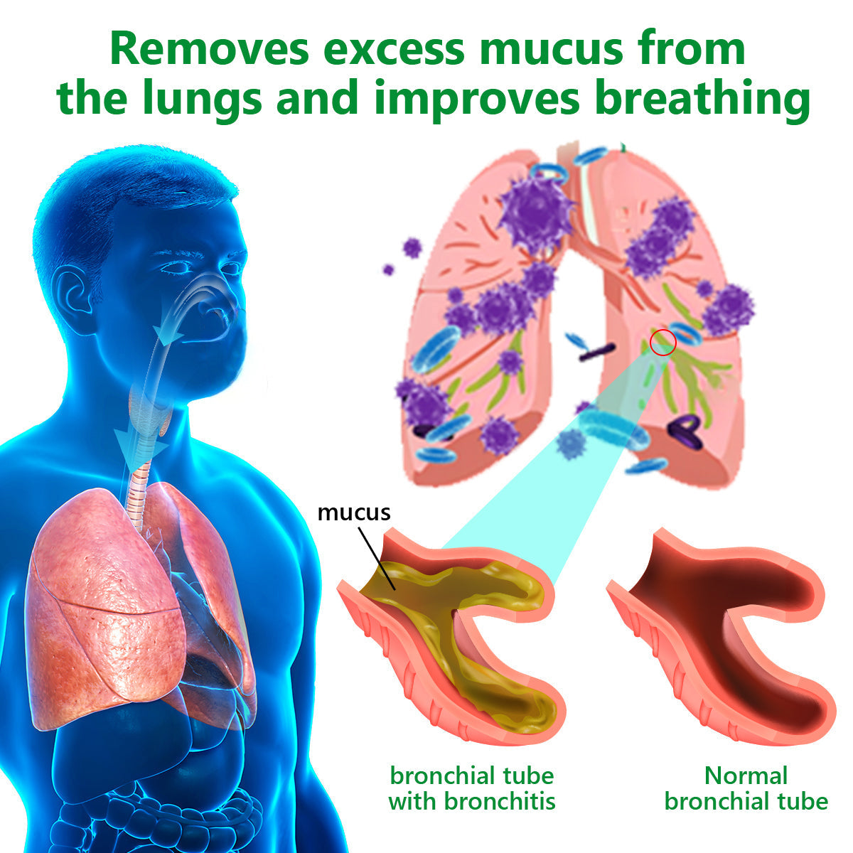 𝙇𝙚𝙧𝙘𝙚𝙖™ 𝙈𝙪𝙡𝙡𝙚𝙞𝙣 𝘾𝙡𝙚𝙖𝙧 𝙇𝙪𝙣𝙜 𝙍𝙚𝙥𝙖𝙞𝙧 𝘾𝙧𝙚𝙖𝙢 - 𝗲𝗻𝗱𝗼𝗿𝘀𝗲𝗱 𝗯𝘆 𝗁𝗵𝗲 𝗕𝗿𝗶𝘁𝗶𝘀𝗲𝗻 𝗧𝗵𝗼𝗿𝗮𝗹 𝗦𝗼𝗰𝗶𝗲𝘀 𝘇𝘂𝗺 𝗠𝗮𝗹𝘀𝘁𝗲𝗻 𝗯𝗶𝘀 𝗯𝗶𝘀𝘁𝗲𝗻 