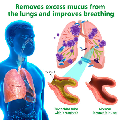 𝙇𝙚𝙧𝙘𝙚𝙖™ 𝙈𝙪𝙡𝙡𝙚𝙞𝙣 𝘾𝙡𝙚𝙖𝙧 𝙇𝙪𝙣𝙜 𝙍𝙚𝙥𝙖𝙞𝙧 𝘾𝙧𝙚𝙖𝙢 - 𝗲𝗻𝗱𝗼𝗿𝘀𝗲𝗱 𝗯𝘆 𝗁𝗵𝗲 𝗕𝗿𝗶𝘁𝗶𝘀𝗲𝗻 𝗧𝗵𝗼𝗿𝗮𝗹 𝗦𝗼𝗰𝗶𝗲𝘀 𝘇𝘂𝗺 𝗠𝗮𝗹𝘀𝘁𝗲𝗻 𝗯𝗶𝘀 𝗯𝗶𝘀𝘁𝗲𝗻 