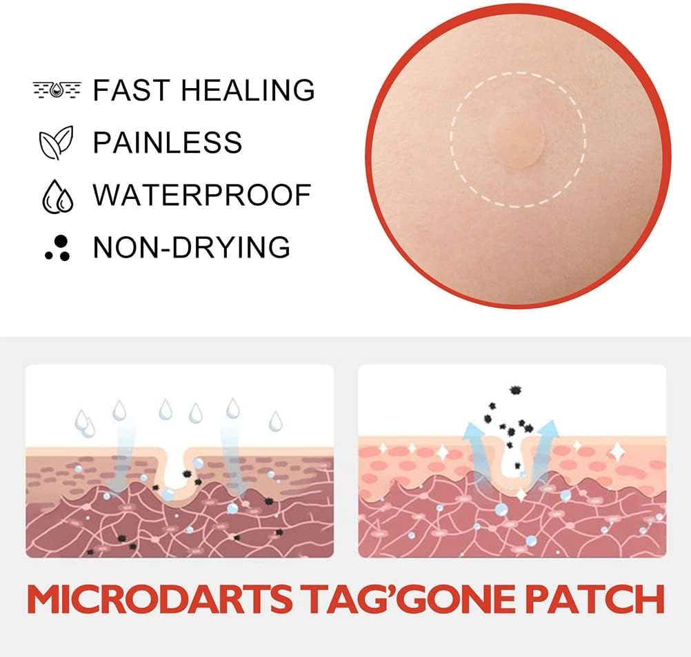 MicroDarts TAG’Gone Patch
