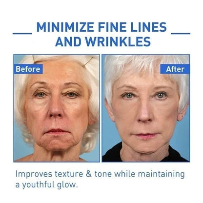 Last Day Promotion 50% OFF - 🔥Botox Face Serum