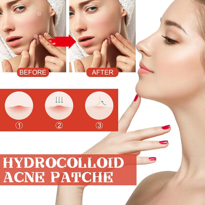 MicroDarts TAG’Gone Patch