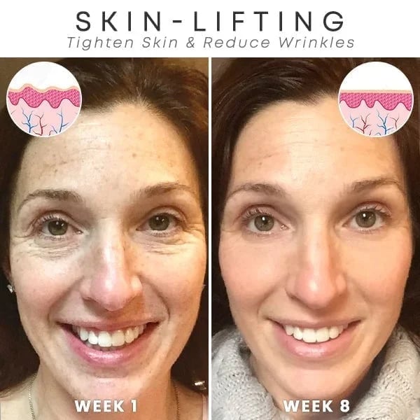 Last Day Promotion 50% OFF - 🔥Botox Face Serum