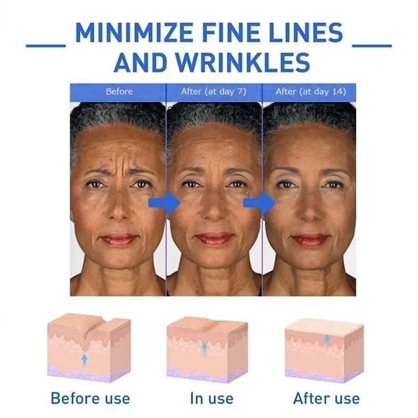 Last Day Promotion 50% OFF - 🔥Botox Face Serum