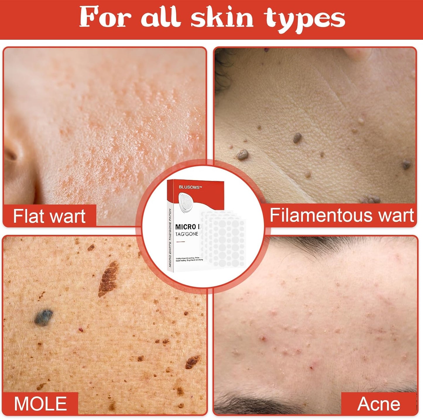 MicroDarts TAG’Gone Patch