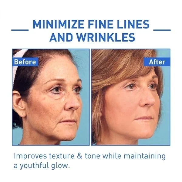 Last Day Promotion 50% OFF - 🔥Botox Face Serum