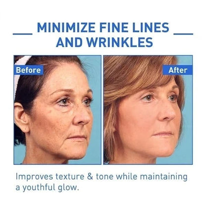 Last Day Promotion 50% OFF - 🔥Botox Face Serum