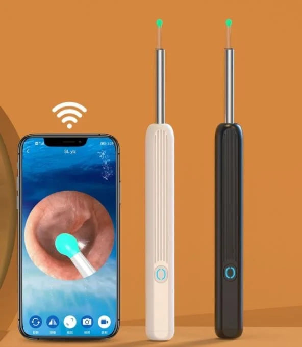 Cuchara para quitar la cera de los oídos con wifi, carga USB 1296P HD 