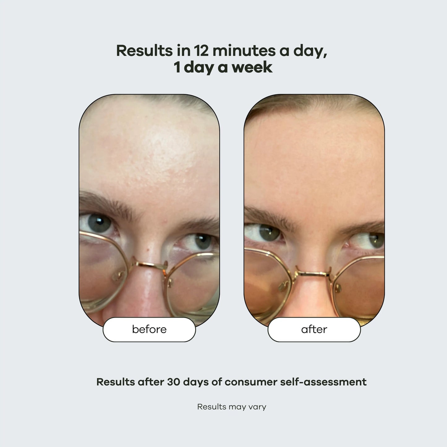 Pore Cleanse: Hydration Handset & Hydra Soothe Serum Kit