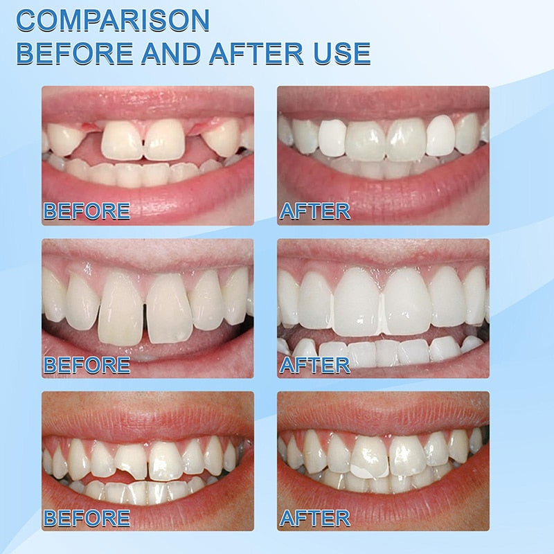 Resina para reparación de dientes