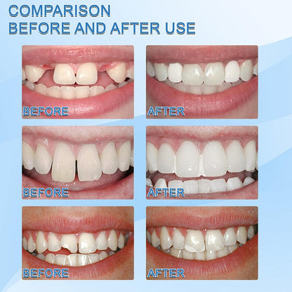Resina para reparación de dientes