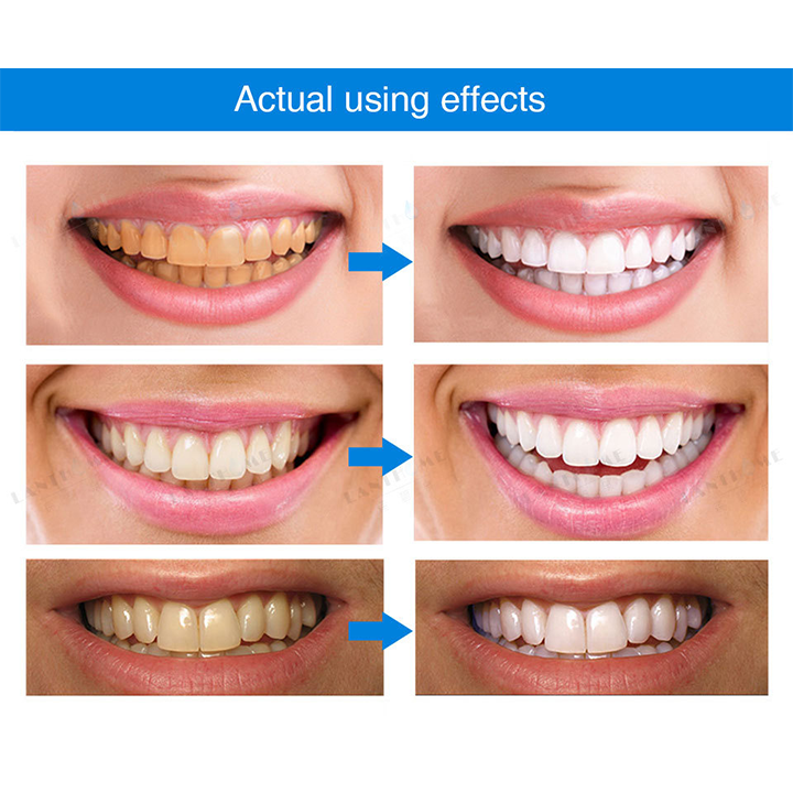 Esencia blanqueadora de dientes