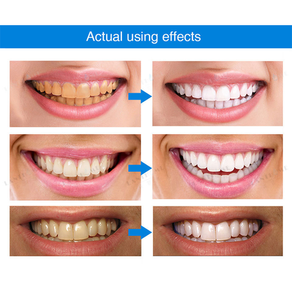Esencia blanqueadora de dientes
